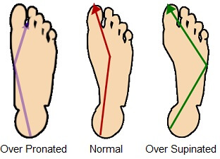 Knee Pain from Running: Diagnosis, Treatment & Prevention