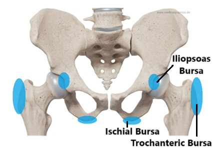 Hip Bursitis: Symptoms, Causes & Treatment