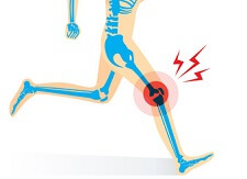 Knee Clunking & Instability - Knee Pain Explained