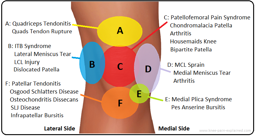 Knee Pain Diagnosis Chart Knee Pain Explained