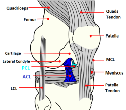 ACL Knee Injury: Symptoms, Causes & Treatment