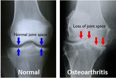 x ray knee injury