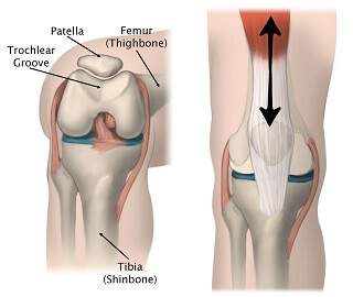 Knee Cap Exercises: Improve Patella Tracking - Knee Pain Explained