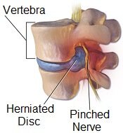 Calf Muscle Pain: Causes & Treatment - Knee Pain Explained