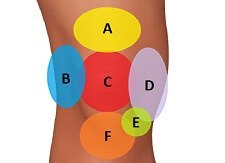 Common Knee Injuries: Causes & Treatment - Knee Pain Explained