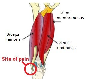 Lateral Knee Pain: Pain On Outside Of Knee - Knee Pain Explained